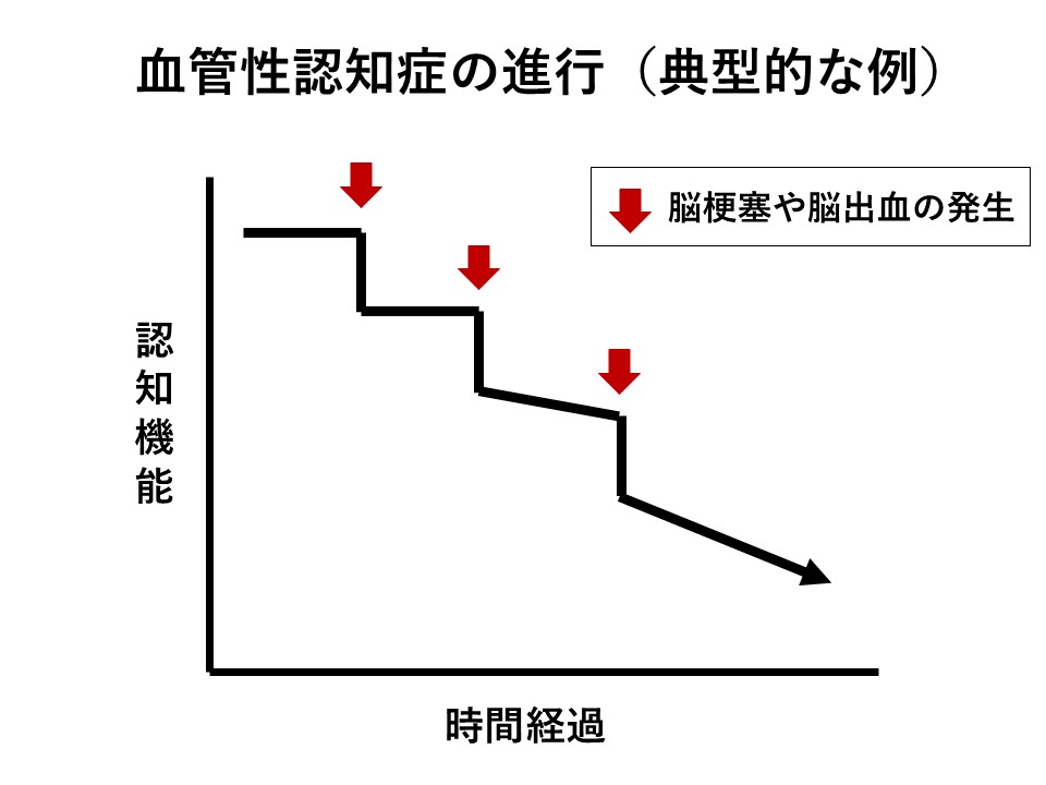 血管性認知症の進行